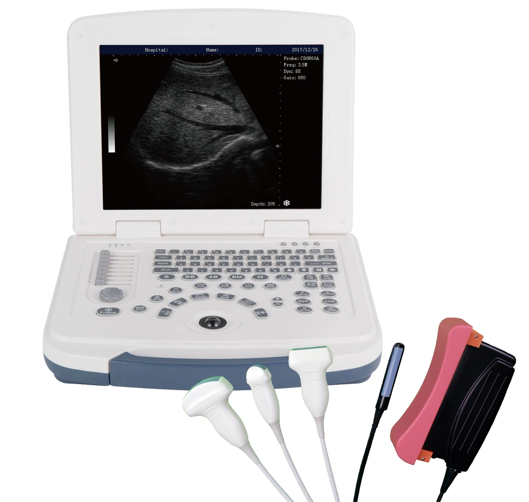 Best Sale Ultrasonic Diagnosis Equipment Laptop B/W Animal Ultrasound Machine