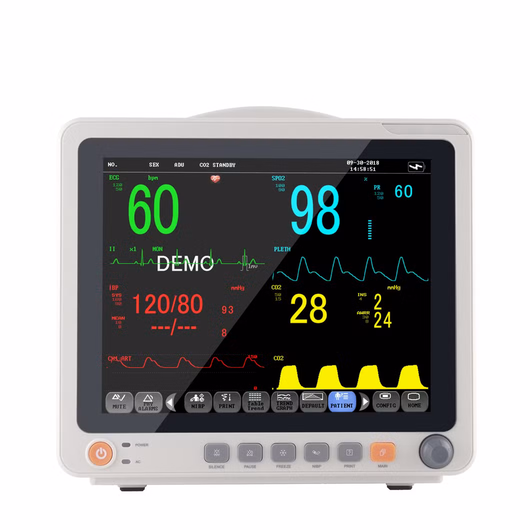 Centralized Patient Monitoring Systems Patient Monitor