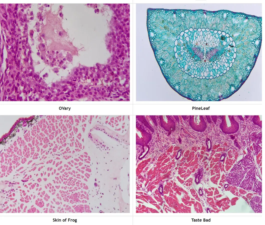 Advanced 4K Microscope Camera with Powerful ISP and Xcamview Technology