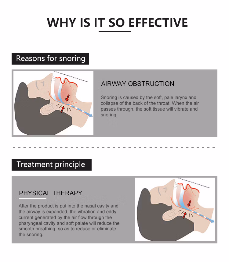 Stop Snoring Solution Health Care Products Humidifier Air Purifier