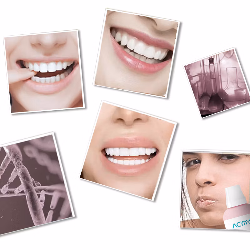 Anti-Sensitive Anti-Cavity Anti-Bacterial Dental Supplies Teeth Whitening Spray Mouthwash with Good Price