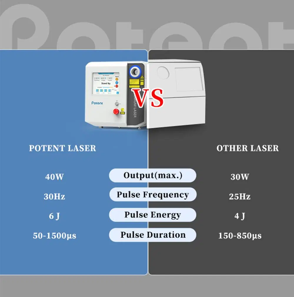 Potent Medical Surgical Equipment High Pulse Energy Portable Holmium Laser Dusting Lithotripsy Urology for Stone Surgery