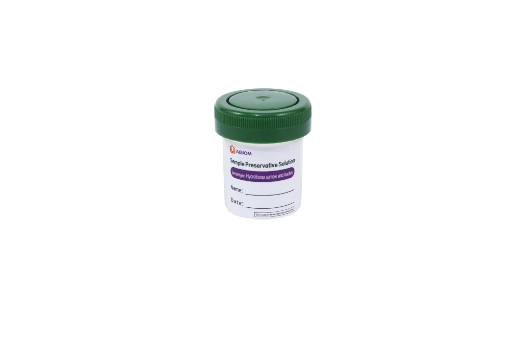 Sample Preservative Solution with Swab Sputum Fresh Tissue