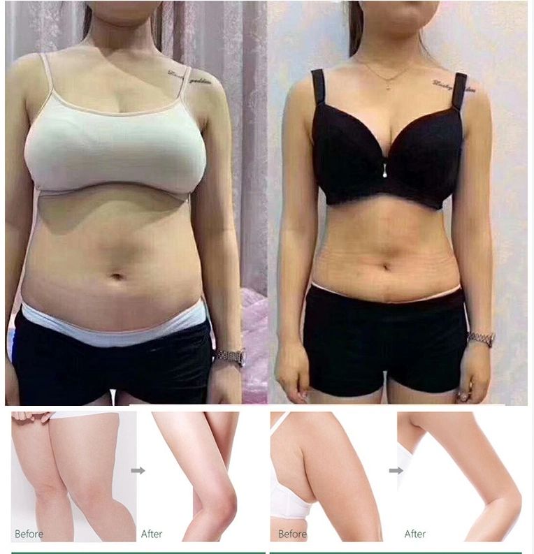 The Red Ampoule Solution Dissolve Body Fat Slimming Fat Dissolving Lipolytic Solution