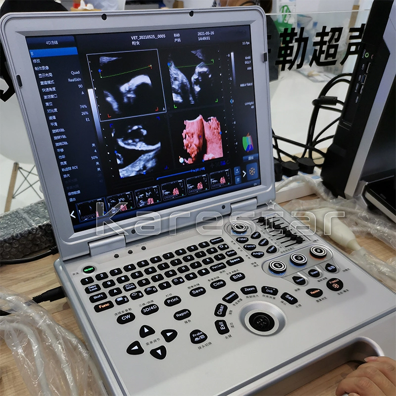 Medical Ultrasound Instruments 3D 4D 5D Color Doppler Portable Ultrasound