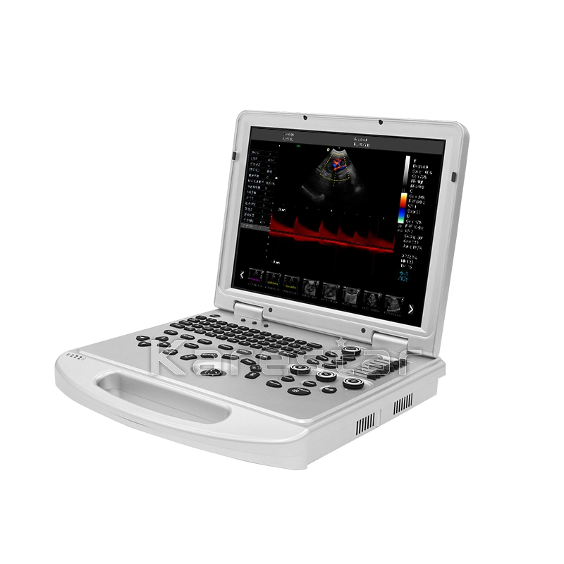 Medical Ultrasound Instruments 3D 4D 5D Color Doppler Portable Ultrasound