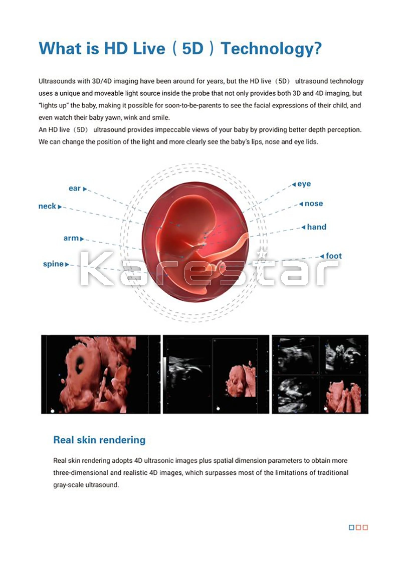 Medical Ultrasound Instruments 3D 4D 5D Color Doppler Portable Ultrasound