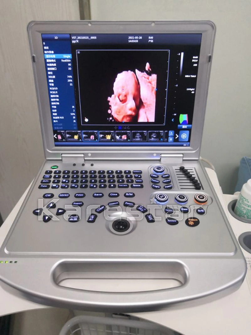 Medical Ultrasound Instruments 3D 4D 5D Color Doppler Portable Ultrasound