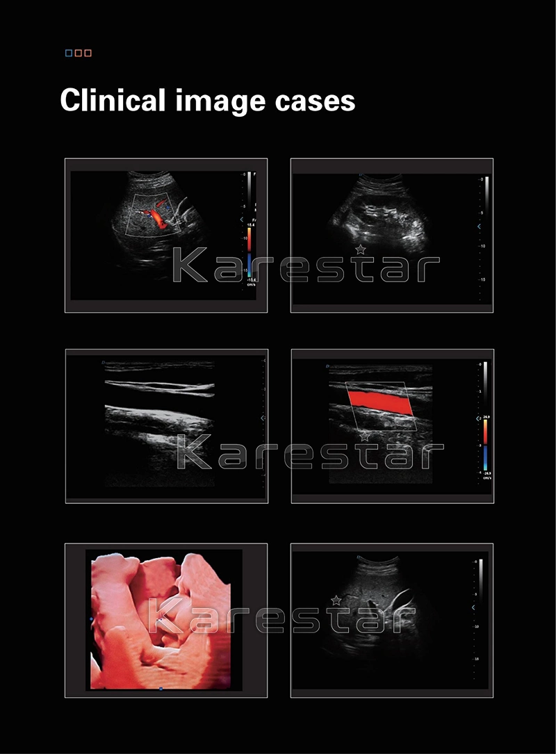 Medical Ultrasound Instruments 3D 4D 5D Color Doppler Portable Ultrasound