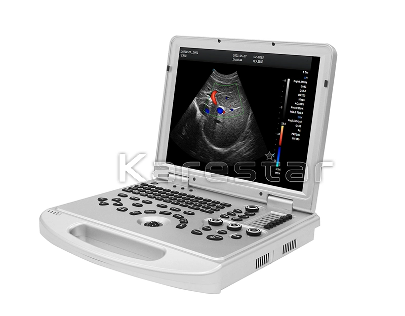 Medical Ultrasound Instruments 3D 4D 5D Color Doppler Portable Ultrasound