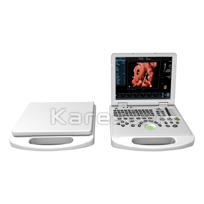 Medical Ultrasound Instruments 3D 4D 5D Color Doppler Portable Ultrasound