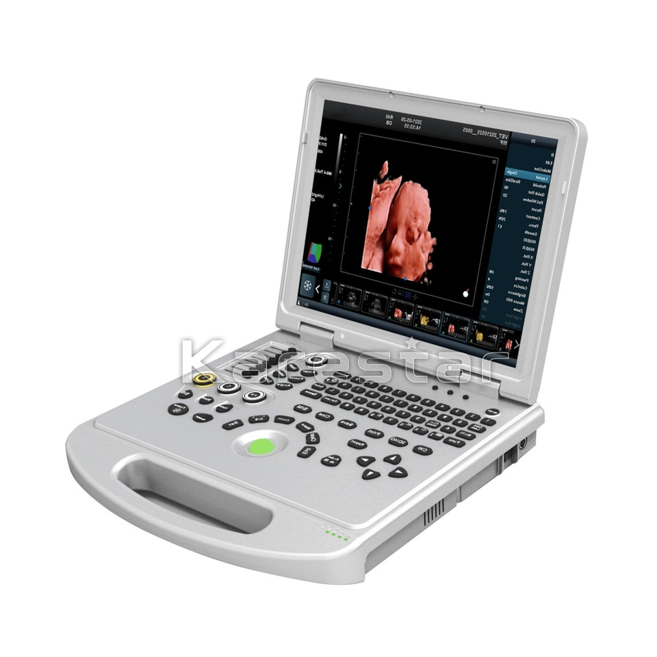 Medical Ultrasound Instruments 3D 4D 5D Color Doppler Portable Ultrasound