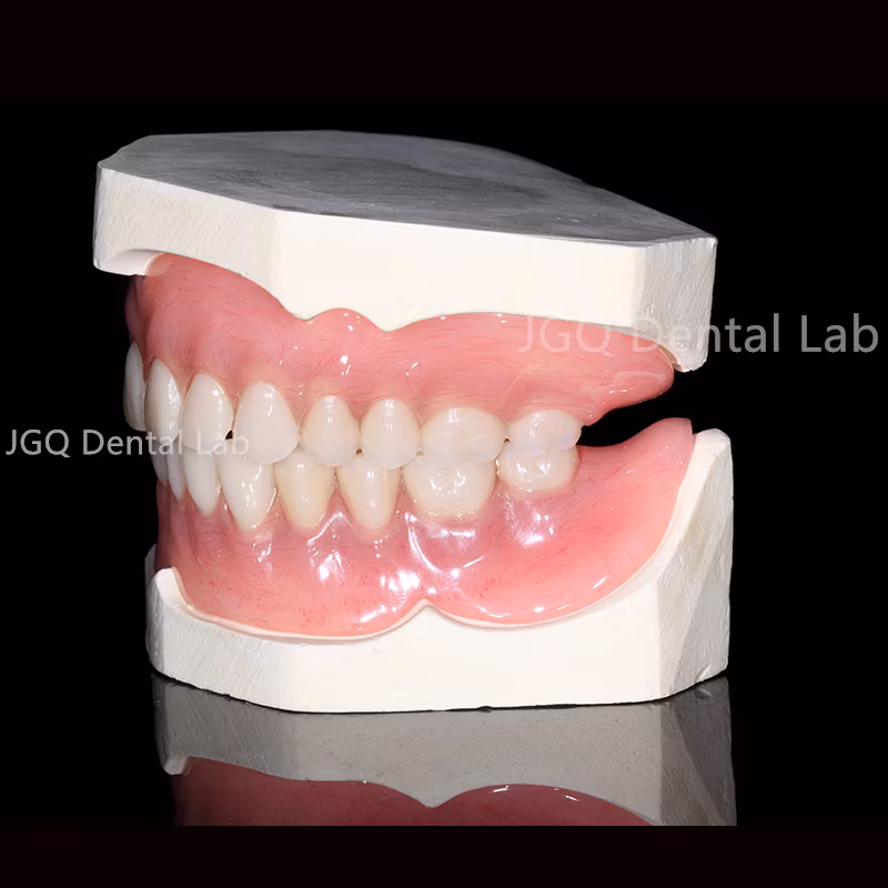 3D Printer Print Metal Crown Long-Span Pfm Dental Bridges with Porcelain Built up