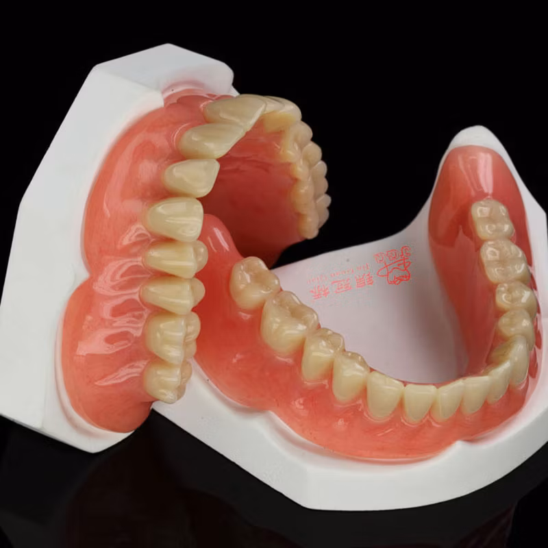3D Printer Print Metal Crown Long-Span Pfm Dental Bridges with Porcelain Built up