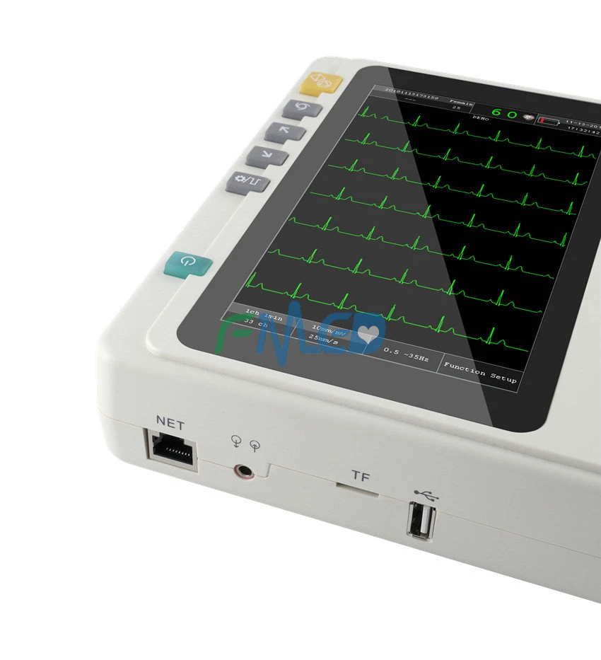 Portable ECG Machine Electrocardiograph ECG Monitor