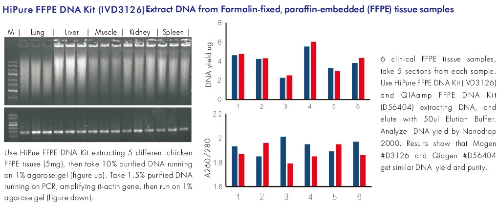 Hipure Ffpe DNA Kit Isolation Total DNA Based on Silica Gel Column