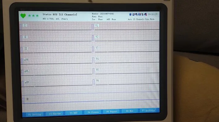 12 Channels Cardiology Twelve EKG Machine, Hospital Digital ECG EKG Electrocardiograph