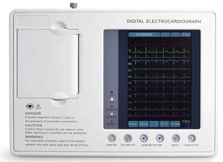 Basic Economical Digital Three Channel Electrocardiograph ECG Machine