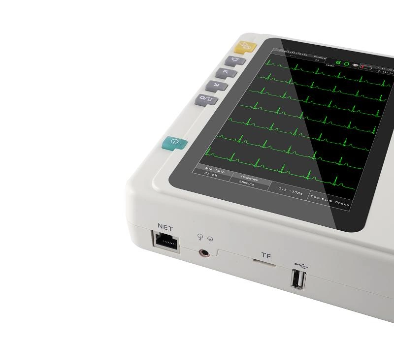 New Design Portable 3 Channel ECG Machines ECG Monitor