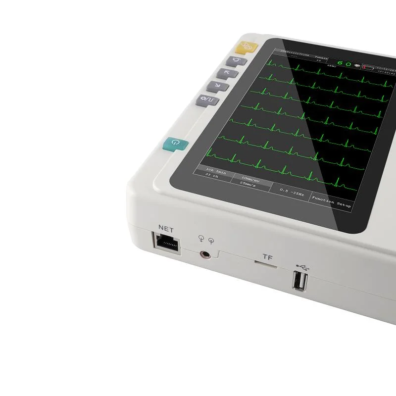 3 Channel 12 Leads ECG Machine Medical ECG Machine Equipment Digital Electrocardiograph