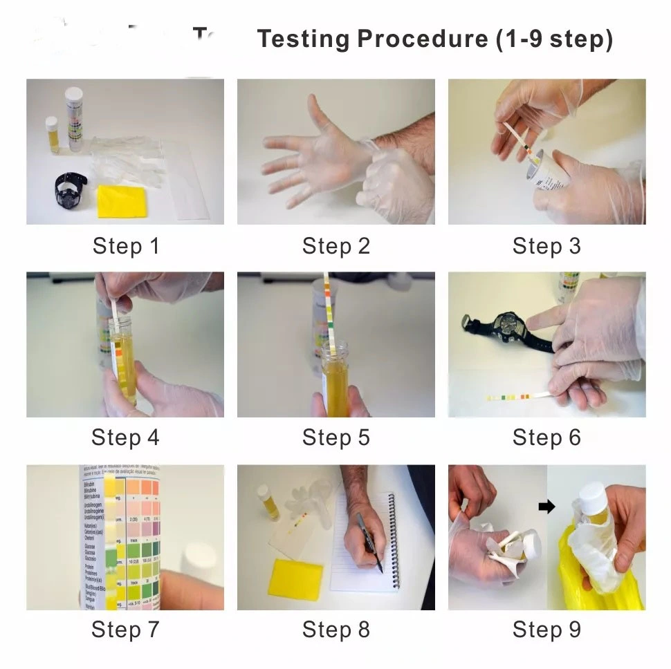 Clinical-Grade 5 Parameter Urine Home Test Strip