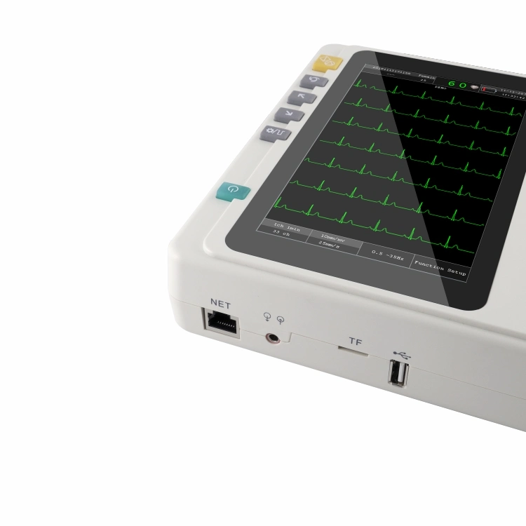 CE Approved Digital 3/6 Channel Portable ECG Machine Electrocardiograph