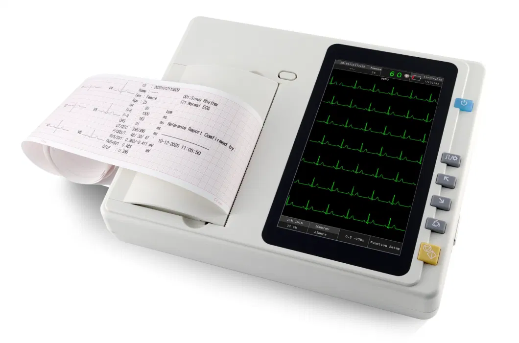 Manufacturer ECG-301 CE Approved 3 Channel 7inch Color Touch Screen Digital Electrocardiograph