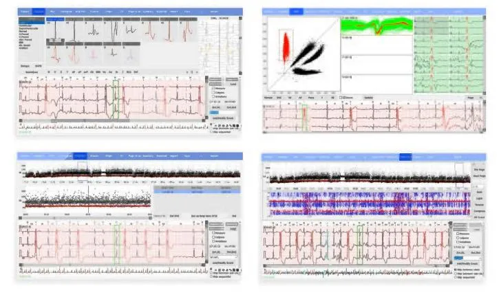 12 Channel Device ECG Monitor System ECG Holter with CE