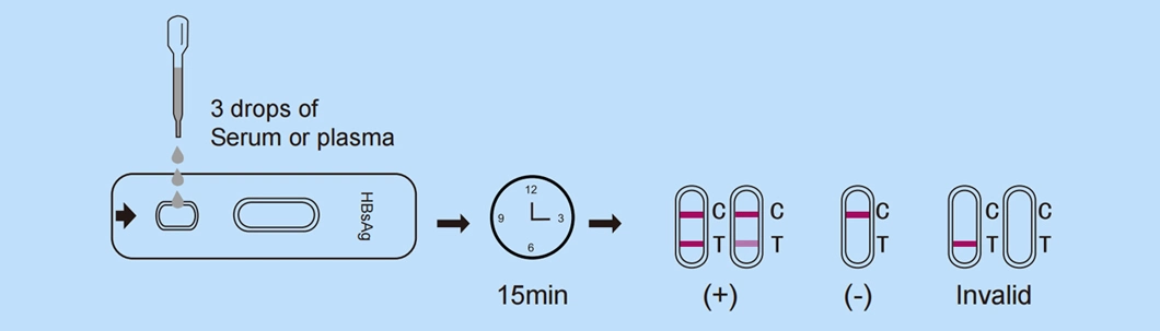 Singclean Wholesale CE Approved Ivd Human Serum and Plasma HBV Hepatitis B Hbsag Rapid Virus Medical Test Kit Surface Antigen (Colloidal Gold) for HBV Infection