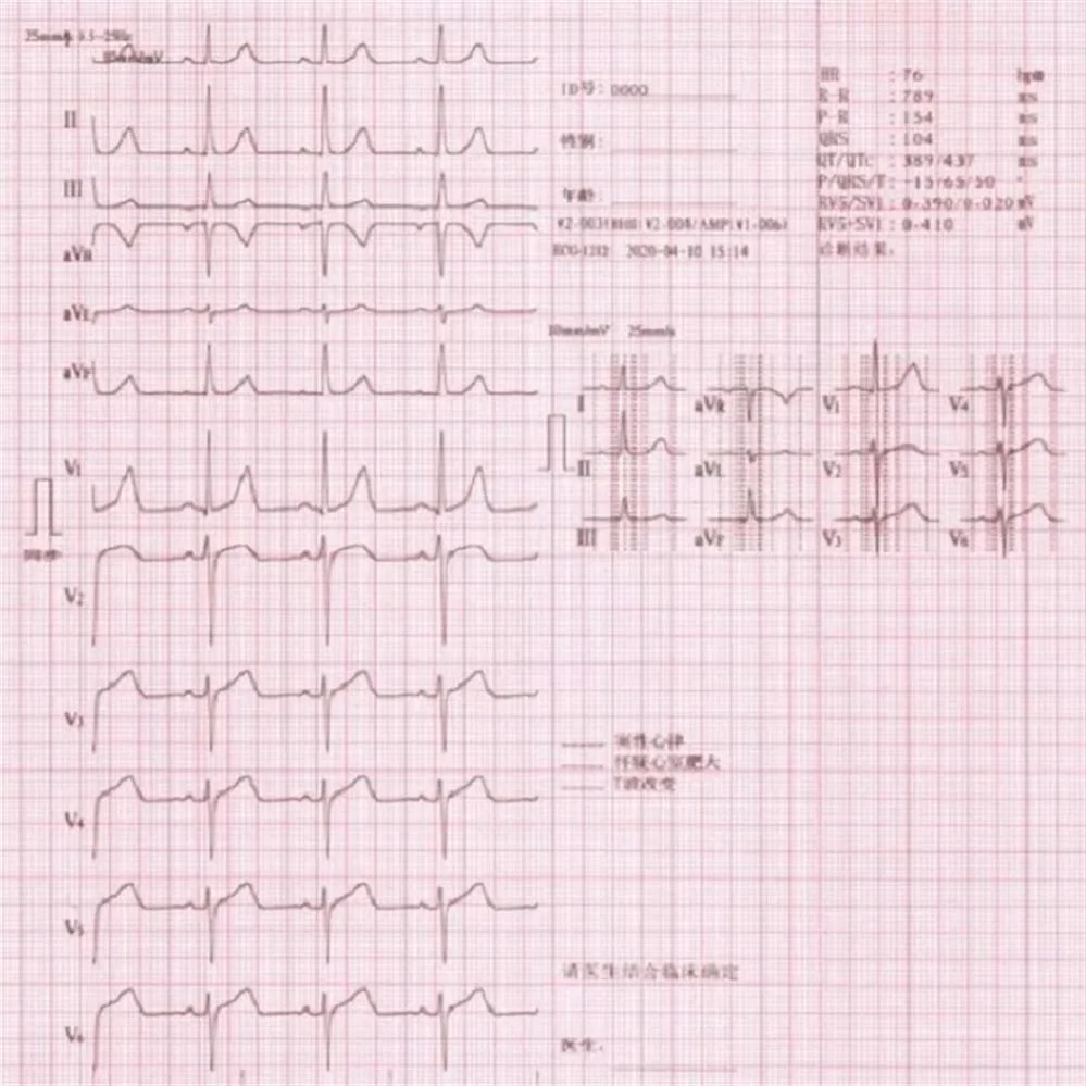 Clinic Digital Bulit-in Battery Portable 12 Channel ECG Machine with Interpretation