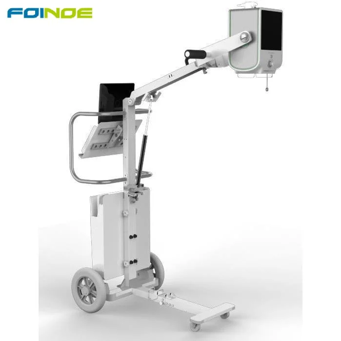 Mobile Digital X-ray Machine Foinoe Hot Sale High Frequency 100 Ma Digital Xray Radiography Medical X Ray Machine