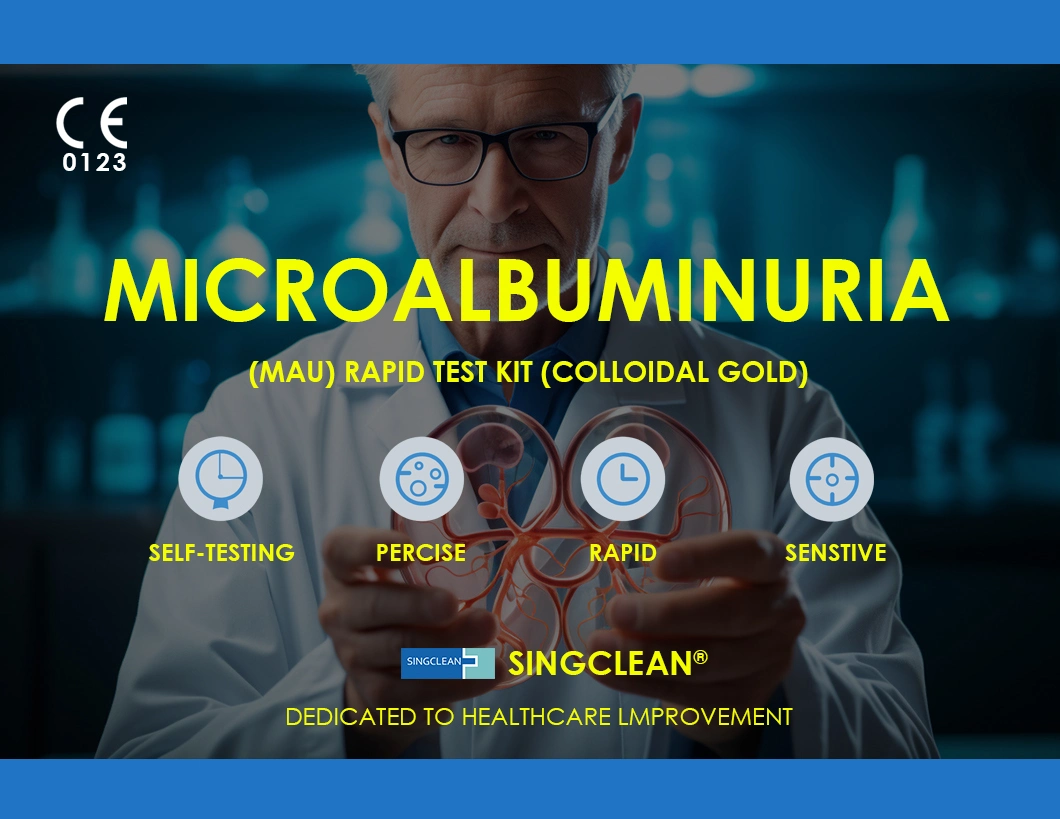 Singclean Wholesale CE Approved Ivd One Step Urine Microalbuminuria Medical Test Kit (Colloidal Gold) for Kidney Disease