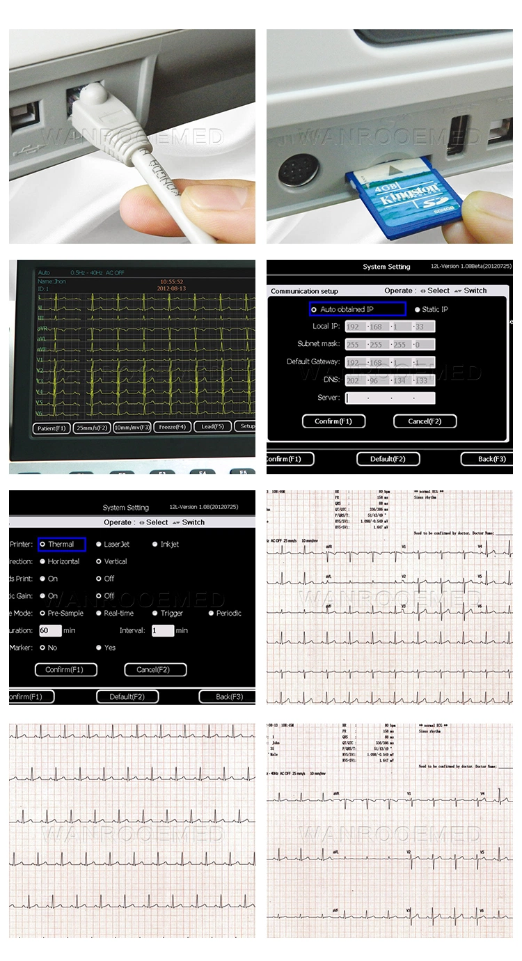 ECG1201 Hospital Portable Digital Electrocardiograph 12 Leads Touch Screen EKG ECG Machine