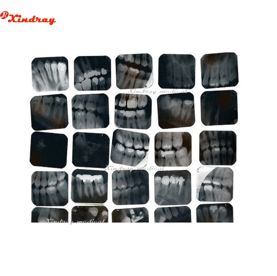 Professional Manufacturer Hospital Equipment Digital Dental Panoramic X-ray Dental Machine