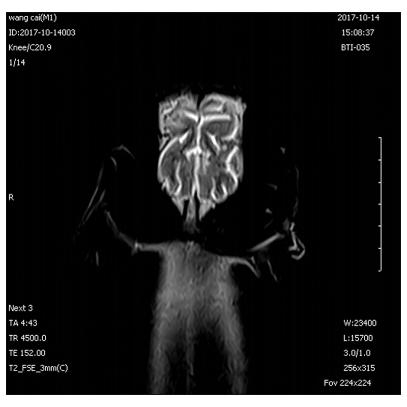 MRI Equipment Animal Hospital Magnetic Resonance Imaging Scanning Machine 0.35t Veterinary MRI Scan Machine