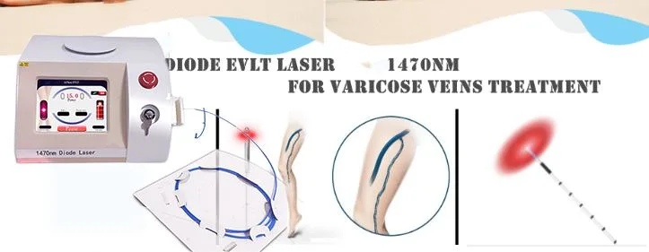 1470nm Fat Melting Laser Endolift Evlt for Varicose Vein Removal Machine