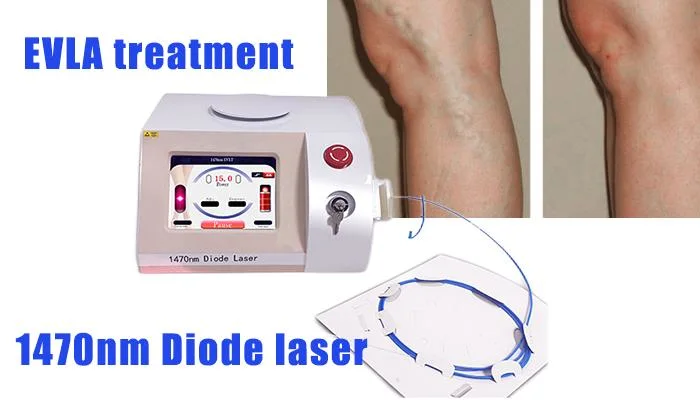 1470nm Fat Melting Laser Endolift Evlt for Varicose Vein Removal Machine