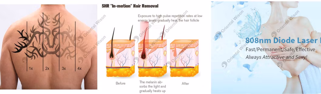 3 in 1 Laser Machine IPL Skin Rejuvenation Diode Laser Hair Removal ND YAG Tattoo Removal Beauty Salon Clinic Machine