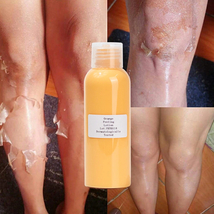 Organic Orange Peeling Lotion Removing Dead Skin Whitening and Smoothing Body Lotion