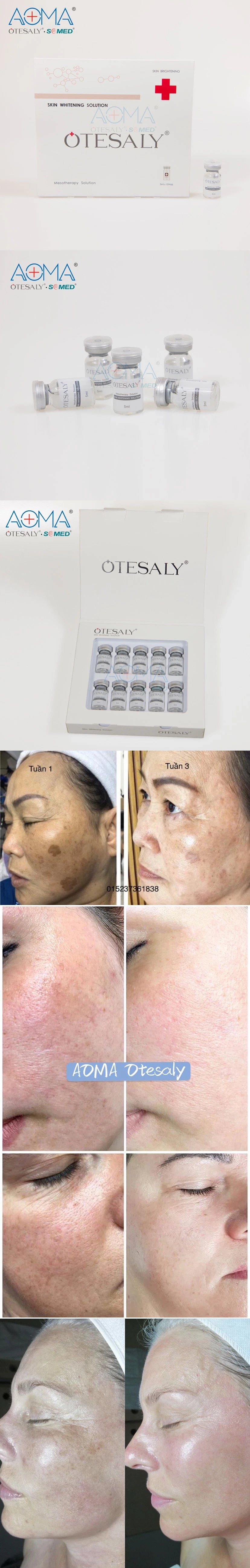 Wholesale Aoma Otesaly Whitening Nourishing Mesotherapy Solution Skin Rejuvenation Injection Serum