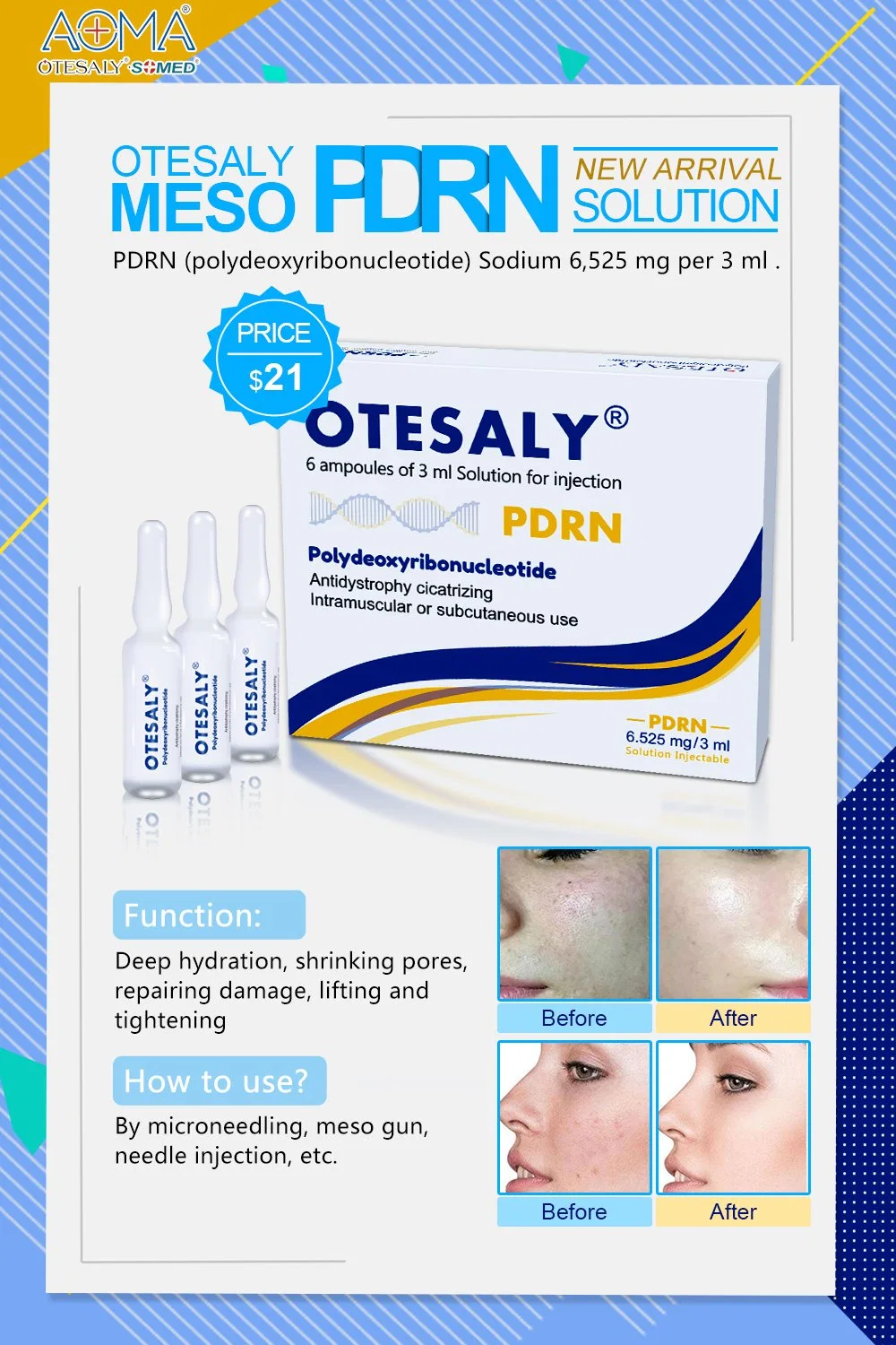 Factory Sell 50ml Otesaly Price Large Pore Otesaly 8 Percent Ha Skin Rejuvenation High Concentration Microneedling Injection Serum Injection