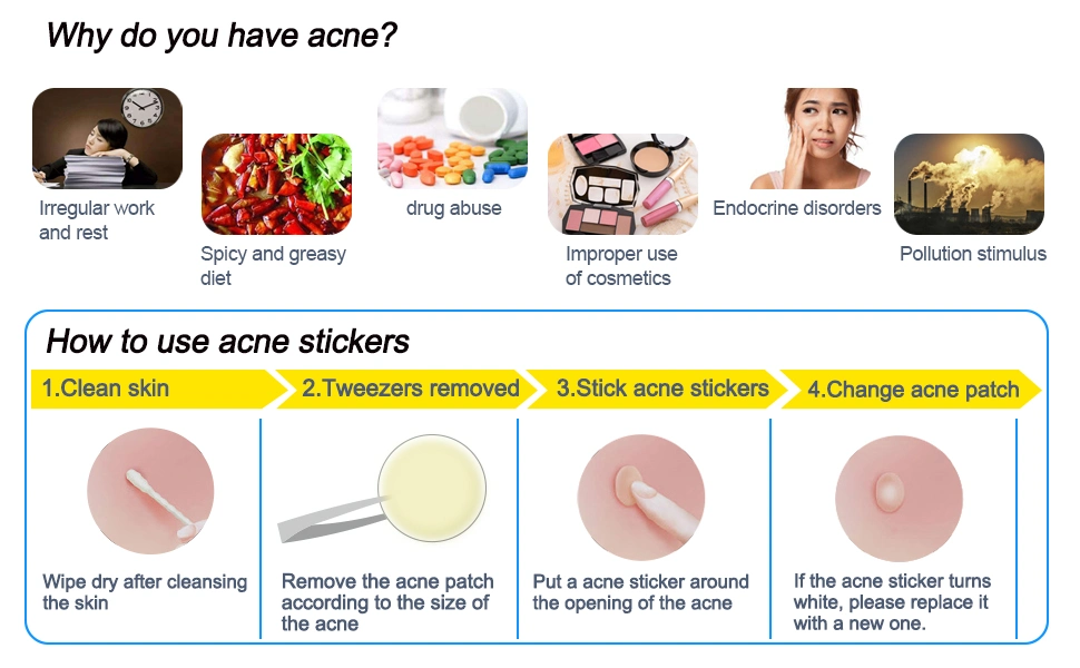 Spot Dots Treatment Acne Patches Private Label Waterproof Hydrocolloid Pimple Acne Patch with Salicylic Acid Skin Care