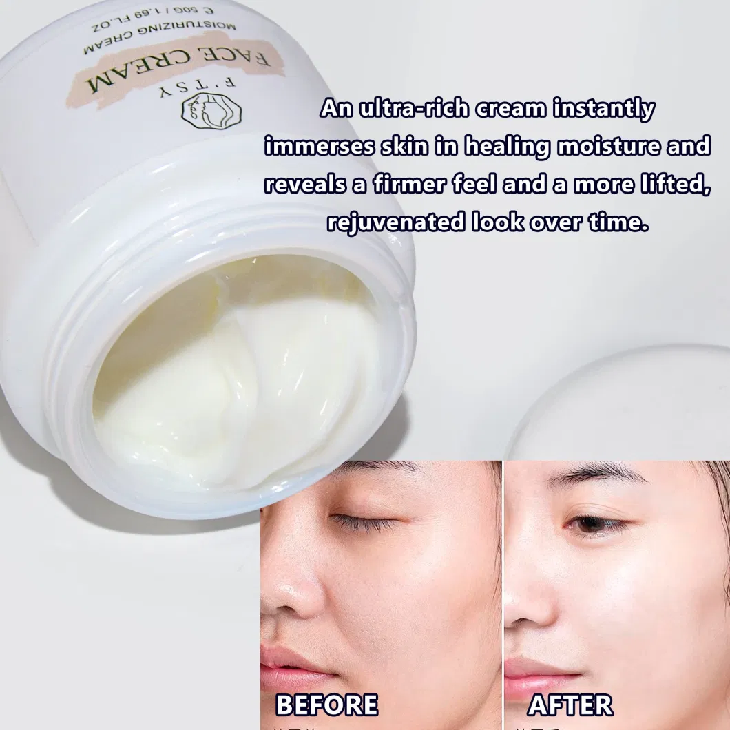 Whitening Acne Dark Spot Removing Curcumin Turmeric Face Cream