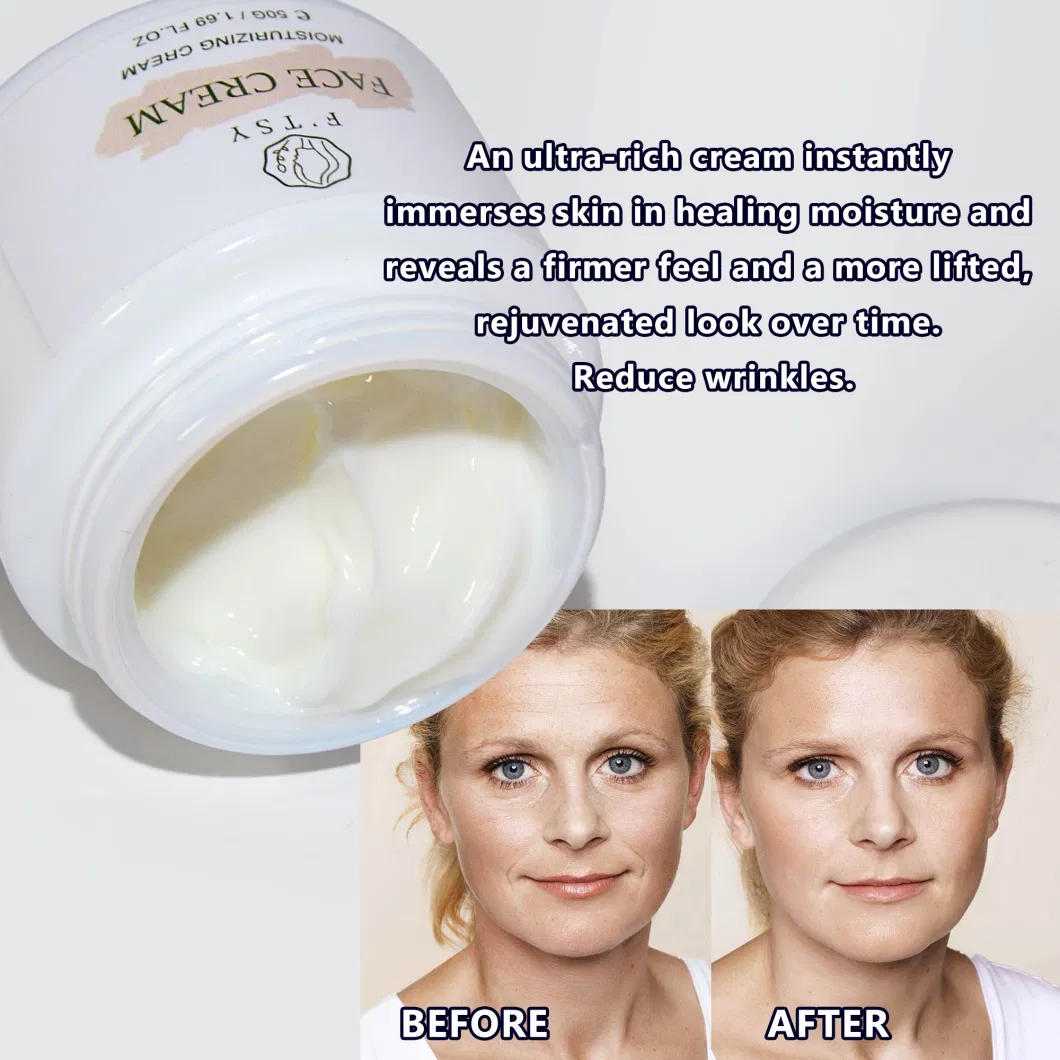 Whitening Acne Dark Spot Removing Curcumin Turmeric Face Cream