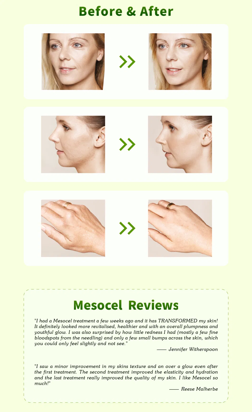 Mesocel Anti Ageing Skin Care Booster Serum Face Glowing for Anti Wrinkle