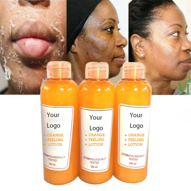 Exfoliating Body Lotion Black Skin Whitening Lightening Orange Peeling Lotion