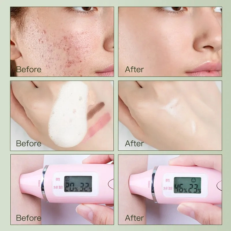 2023 New Facial Cleanser Gel Acne Treatment Face Brightening Oil Control Rich Foam Natural Face Wash Skin Care