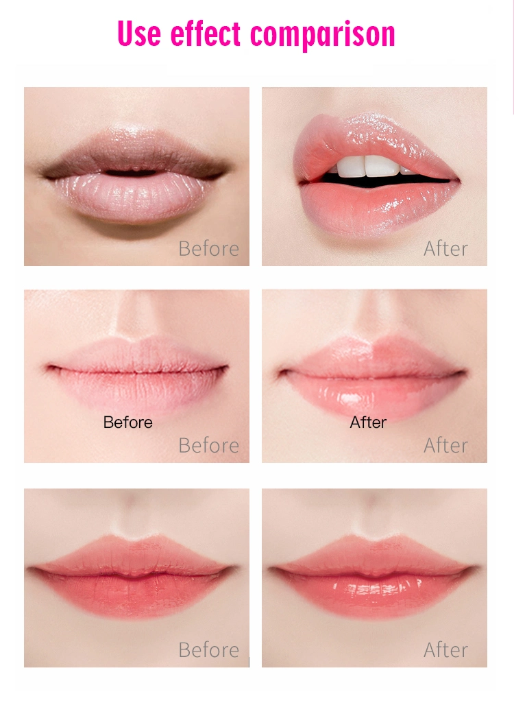 Best Hydro-Gel Lips Care Elastic Lip Patch Deep Nourishing Treatment Hydrating Lip Mask