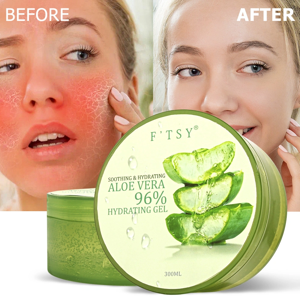 Custom Aloe Vera Hydrating Gel Hyaluronic Acid Face Care Gel