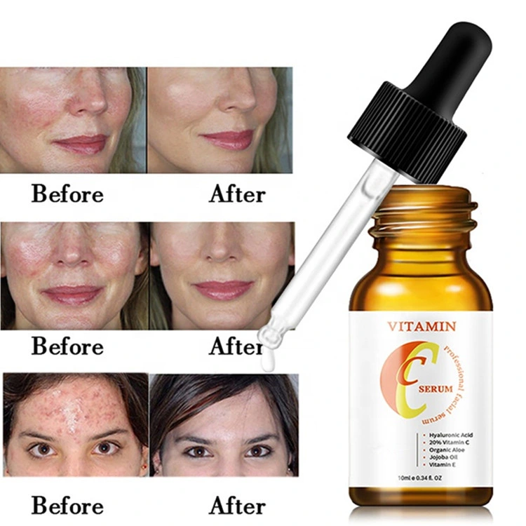 Custom Logo Anti-Aging Lighting Skin Whitening Moisture Vitamin C Serum for Face